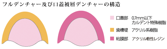 フルデンチャー及び口蓋被層デンチャーの構造