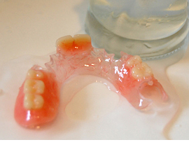 針金の無いノンクラスプ義歯