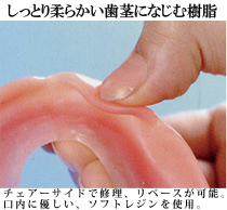 しっとり柔らかい歯になじむ樹脂